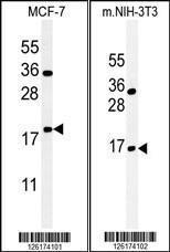 Anti-BTG1 Rabbit Polyclonal Antibody (APC (Allophycocyanin))