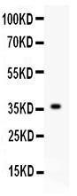 Anti-FGF1/Fgf Acidic Polyclonal Antibody