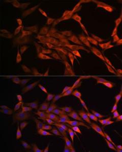 Immunofluorescence analysis of NIH-3T3 cells using Anti-PAK1 Antibody [ARC0087] (A307809). DAPI was used to stain the cell nuclei (blue)