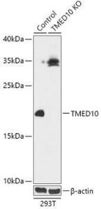 Western blot analysis of extracts from normal (control) and TMED10 knockout (KO) 293T cells, using Anti-TMP21 Antibody (A92862) at 1:1,000 dilution