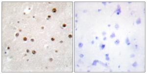 Immunohistochemical analysis of paraffin-embedded human brain tissue using Anti-TSN Antibody. The right hand panel represents a negative control, where the Antibody was pre-incubated with the immunising peptide