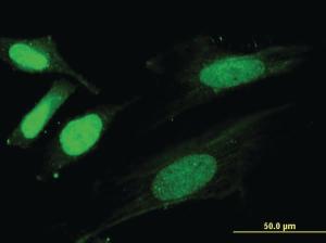 Anti-SNX20 Mouse Monoclonal Antibody [clone: 4E9]