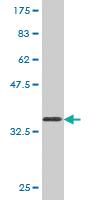 Anti-NPY Mouse Monoclonal Antibody [clone: 3F11]