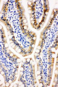 Anti-Peroxiredoxin 3 Rabbit Polyclonal Antibody