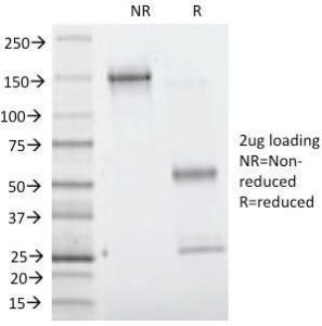 Anti-Villin antibody