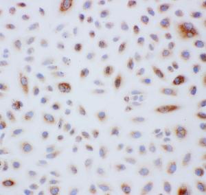 Anti-Peroxiredoxin 3 Rabbit Polyclonal Antibody