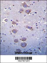 Anti-TLR8 Rabbit Polyclonal Antibody (APC (Allophycocyanin))