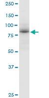 Anti-ADARB1 Mouse Polyclonal Antibody