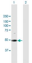 Anti-SOCS5 Rabbit Polyclonal Antibody