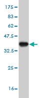 Anti-GOLGA5 Mouse Monoclonal Antibody [clone: 6B3]