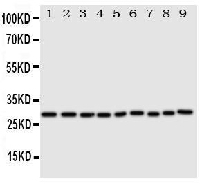 Anti-Peroxiredoxin 3 Rabbit Polyclonal Antibody