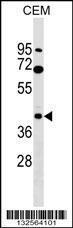 Anti-CACNG3 Rabbit Polyclonal Antibody (AP (Alkaline Phosphatase))