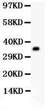 Anti-RACK1 Polyclonal Antibody