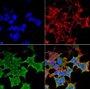 Immunocytochemistry/Immunofluorescence analysis of human neuroblastoma cell line (SK-N-BE, fixed in 4% formaldehyde for 15  min at room temperature, using Anti-LGI1 Antibody [S283-7] (A305011), at 1:100 for 60  minutes at room temperature.