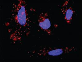 Anti-CDK6 + RUNX1 Antibody Pair