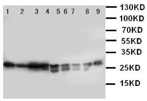 Anti-Peroxiredoxin 3 Rabbit Polyclonal Antibody