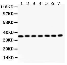 Anti-RACK1 Polyclonal Antibody