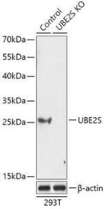 Western blot analysis of extracts from normal (control) and UBE2S knockout (KO) 293T cells, using Anti-UBE2S Antibody (A92864) at 1:1,000 dilution. The secondary antibody was Goat Anti-Rabbit IgG H&L Antibody (HRP) at 1:10,000 dilution.