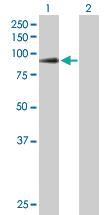 Anti-ADARB1 Mouse Polyclonal Antibody