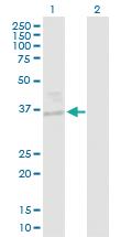 Anti-EHF Rabbit Polyclonal Antibody