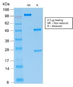 SDS-PAGE analysis of Anti-PAX5 Antibody [rPAX5/2060] under non-reduced and reduced conditions; showing intact IgG and intact heavy and light chains, respectively. SDS-PAGE analysis confirms the integrity and purity of the antibody