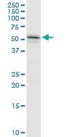 Anti-TYRP1 Mouse Polyclonal Antibody