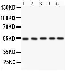 Anti-ARSA Rabbit Polyclonal Antibody