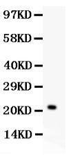 Anti-IL-18 Polyclonal Antibody