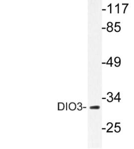 Antibody anti-DIO3 100 µg