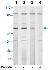 Anti-TBX15 Rabbit Polyclonal Antibody