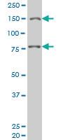 Anti-LRRFIP1 Mouse Monoclonal Antibody [clone: 3E1]