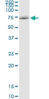 Anti-SOCS5 Rabbit Polyclonal Antibody