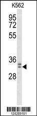 Anti-WDR83 Rabbit Polyclonal Antibody (PE (Phycoerythrin))