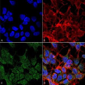 Immunocytochemistry/Immunofluorescence analysis of human neuroblastoma cell line (SK-N-BE, fixed in 4% formaldehyde for 15  min at room temperature, using Anti-VGLUT2 Antibody [S29-29] (A305012), at 1:100 for 60  minutes at room temperature.