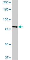 Anti-ADARB1 Mouse Polyclonal Antibody