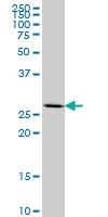 Anti-MEOX2 Mouse Monoclonal Antibody [clone: 4B2]