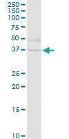 Anti-EHF Rabbit Polyclonal Antibody