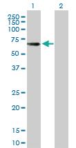 Anti-TYRP1 Mouse Polyclonal Antibody