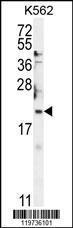 Anti-BTG2 Rabbit Polyclonal Antibody (Biotin)