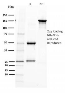 SDS-PAGE analysis of Anti-PAX5 Antibody [PAX5/2595] under non-reduced and reduced conditions; showing intact IgG and intact heavy and light chains, respectively. SDS-PAGE analysis confirms the integrity and purity of the antibody