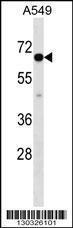 Anti-CLPTM1L Rabbit Polyclonal Antibody (Biotin)