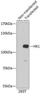 Western blot analysis of extracts of 293T cells, using Anti-Hexokinase 1 Antibody (A8428)