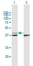 Anti-PSMD13 Mouse Polyclonal Antibody