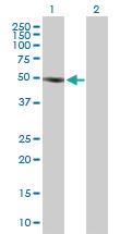 Anti-SOCS5 Rabbit Polyclonal Antibody