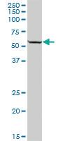 Anti-TYRP1 Mouse Polyclonal Antibody