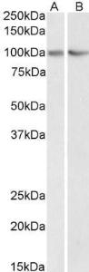 Anti-TRIM71 Antibody (A84789) (0.3 µg/ml) staining of HEK293 (A) and NIH3T3 (B) lysate (35 µg protein in RIPA buffer). Primary incubation was 1 hour. Detected by chemiluminescence