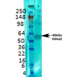 Western blot analysis of rat brain membrane lysate showing detection of VGLUT2 protein using Anti-VGLUT2 Antibody [S29-29] (A305012) at 1:000