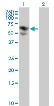 Anti-BTD Mouse Monoclonal Antibody [clone: 3B10-2B3]