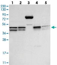 Anti-RMDN2 Rabbit Polyclonal Antibody