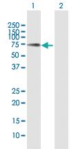 Anti-TYRP1 Rabbit Polyclonal Antibody